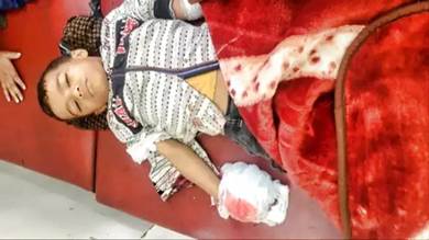 إصابة طفل بعملية قنص حوثي بتعز